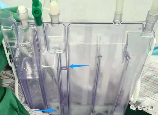 为什么负压引流胸管引流知识点_https://www.jmylbn.com_新闻资讯_第2张