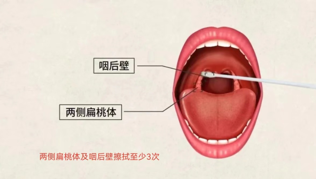 流感病毒怎么采样流行性感冒实验室病原学检查相关知识科普_https://www.jmylbn.com_新闻资讯_第4张