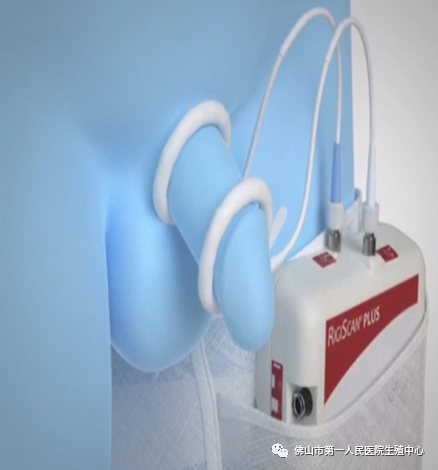 性功能检测仪是什么前沿高科技检测“男”言之隐——Rigiscan勃起功能检测仪在市一医院男科的应用_https://www.jmylbn.com_新闻资讯_第4张