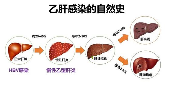 我国慢乙肝患者存量大,规范治疗仍是乙肝