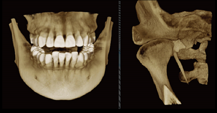 口腔ct什么牌子好黑科技口腔CT助力医院跑好2023年开局“第一棒”_https://www.jmylbn.com_新闻资讯_第3张