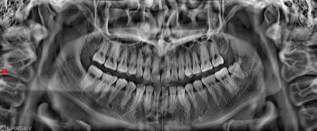 口腔ct什么牌子好黑科技口腔CT助力医院跑好2023年开局“第一棒”_https://www.jmylbn.com_新闻资讯_第6张