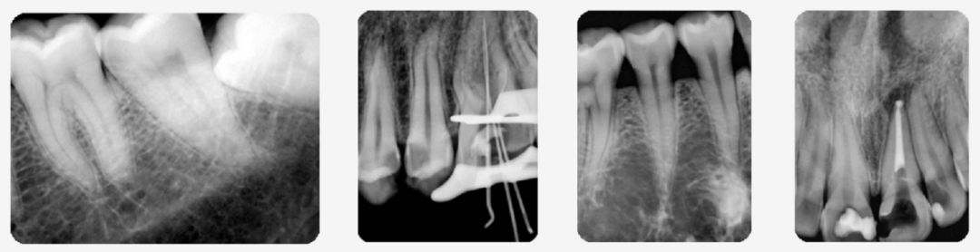 口腔ct什么牌子好黑科技口腔CT助力医院跑好2023年开局“第一棒”_https://www.jmylbn.com_新闻资讯_第9张