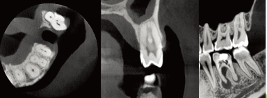 口腔ct什么牌子好黑科技口腔CT助力医院跑好2023年开局“第一棒”_https://www.jmylbn.com_新闻资讯_第4张