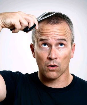 中年男性脱发出油怎么治？