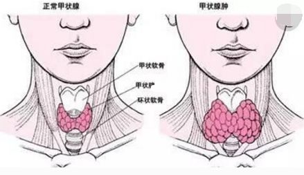 穿刺枪怎么升级乳腺穿刺术（三）_https://www.jmylbn.com_新闻资讯_第80张