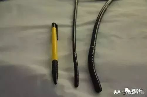 为什么活检钳不是一次性健康科普︱胃镜是一次性的吗？胃肠镜能不能同时做？胃肠镜检查13问，一文解决。_https://www.jmylbn.com_新闻资讯_第5张