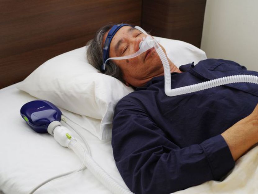 cpap要用多久阻塞性睡眠呼吸暂停（OSA）的持续气道正压通气（CPAP）治疗-AED除颤器产品网
