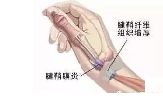 牙医必看！你的双手很重要！