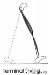 步态分析上曲线怎么解读以“RLA八分法”分析人体正常步态！_https://www.jmylbn.com_新闻资讯_第13张