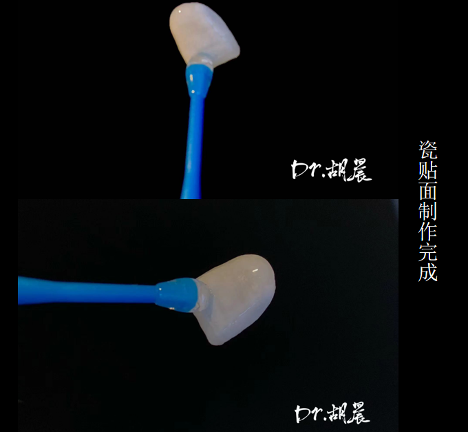 为什么牙医不用开口器特邀牙医【实操病例】集锦{9.22}_https://www.jmylbn.com_新闻资讯_第4张