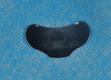 为什么牙医不用开口器特邀牙医【实操病例】集锦{9.22}_https://www.jmylbn.com_新闻资讯_第26张