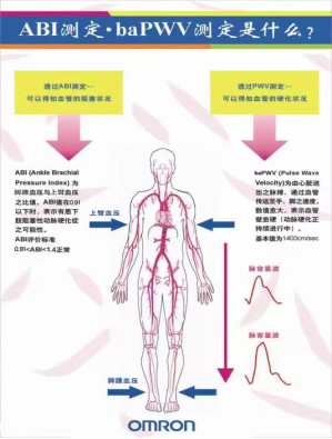 动脉硬化检测仪怎么用可早期发现心脑血管病变，欧姆龙（Omron BP-203RPEIII ）动脉硬化检测仪在我院投入使用 ｜ 患者福音_https://www.jmylbn.com_新闻资讯_第6张