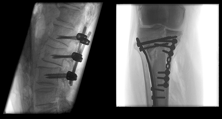 c臂机怎么开机飞利浦、西门子...国内外C型臂X射线机大盘点_https://www.jmylbn.com_新闻资讯_第6张