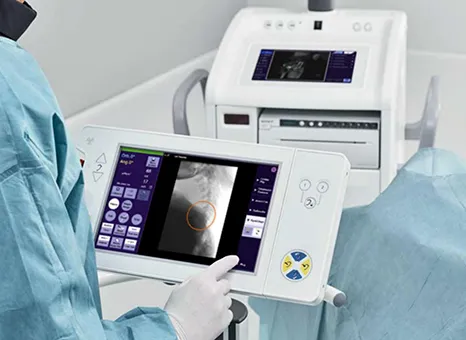 c臂机怎么开机飞利浦、西门子...国内外C型臂X射线机大盘点_https://www.jmylbn.com_新闻资讯_第5张