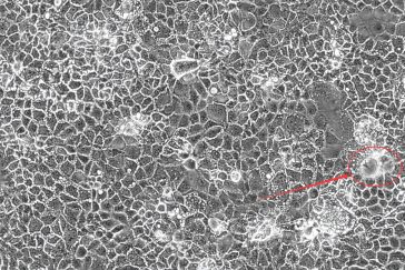 76人结直肠腺癌细胞(caco-2)一般呈岛状生长,caco-2细胞群中常常