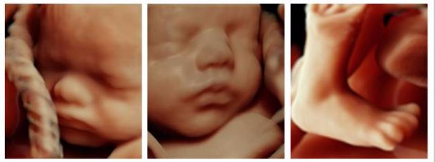 ge彩超怎么样康达医院引进国际领先金标版GE-E10四维彩超  提升我县妇幼健康服务能力_https://www.jmylbn.com_新闻资讯_第6张