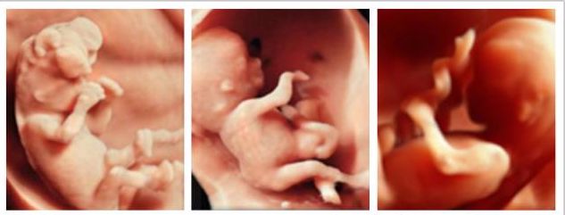 VOlusonE什么彩超机「升级」“金标版”GE Voluson E10四维彩超——从高清到高精，每一帧都是爱与期待的模样_https://www.jmylbn.com_新闻资讯_第8张