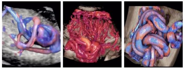 VOlusonE什么彩超机「升级」“金标版”GE Voluson E10四维彩超——从高清到高精，每一帧都是爱与期待的模样_https://www.jmylbn.com_新闻资讯_第9张