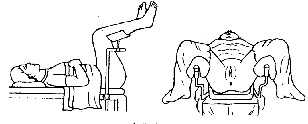 妇科检查床怎么组合妇科检查操作流程及视频_https://www.jmylbn.com_新闻资讯_第17张