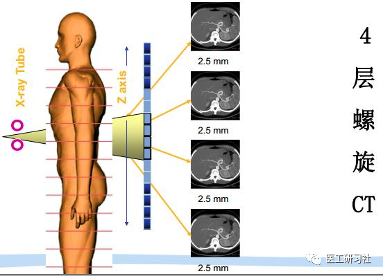 中国为什么不能生产医用螺旋ct机国产CT奋斗史_https://www.jmylbn.com_新闻资讯_第2张