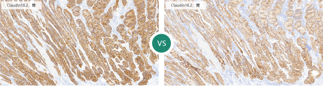 组织块大怎么包埋仅需12步，助你做出完美免疫组化IHC片子_https://www.jmylbn.com_新闻资讯_第13张