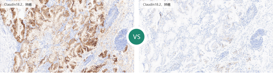 组织块大怎么包埋仅需12步，助你做出完美免疫组化IHC片子_https://www.jmylbn.com_新闻资讯_第12张