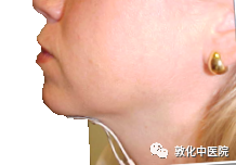 怎么买神经肌肉康复仪【带您了解康复版块】吞咽神经和肌肉电刺激仪，效果很“哇塞”_https://www.jmylbn.com_新闻资讯_第9张