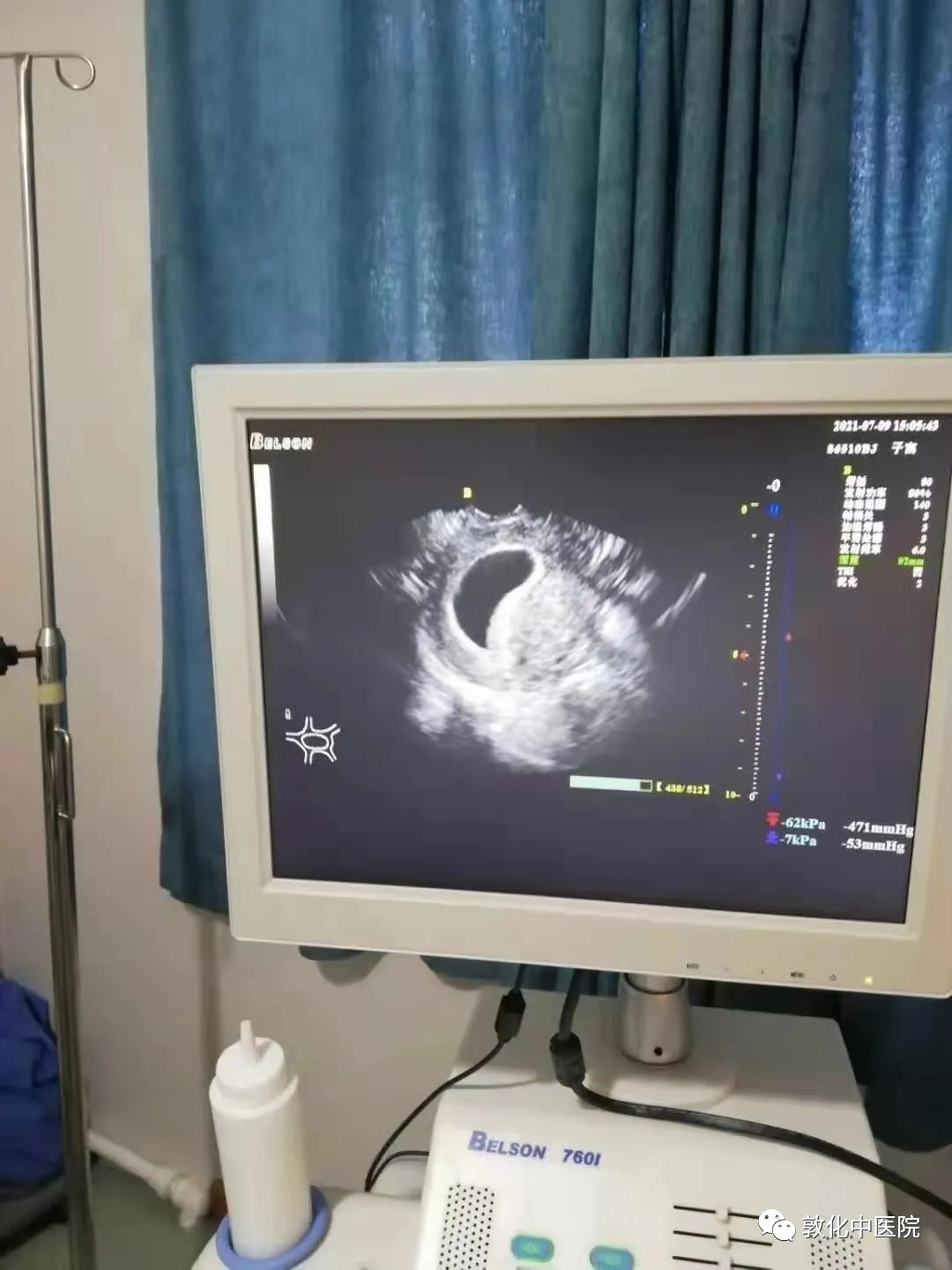 超声引导人流是什么中医院超导可视无痛人流术，给女性最贴心的保护_https://www.jmylbn.com_新闻资讯_第2张