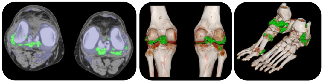 飞利浦都有哪些系列CT设备再升级 ｜ 飞利浦极速ICT，更大程度满足影像检查需求！_https://www.jmylbn.com_新闻资讯_第26张