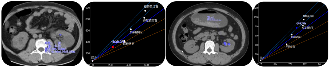 飞利浦都有哪些系列CT设备再升级 ｜ 飞利浦极速ICT，更大程度满足影像检查需求！_https://www.jmylbn.com_新闻资讯_第27张