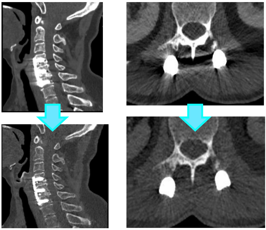 飞利浦都有哪些系列CT设备再升级 ｜ 飞利浦极速ICT，更大程度满足影像检查需求！_https://www.jmylbn.com_新闻资讯_第25张