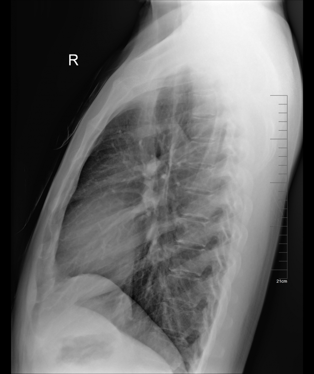 X光拍片为什么要等都是拍片，DR、CT、MRI，到底啥区别？_https://www.jmylbn.com_新闻资讯_第5张