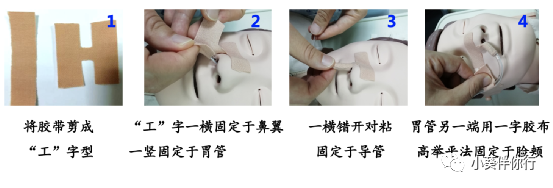 一次性胃管干什么用的胃管，您知多少？_https://www.jmylbn.com_新闻资讯_第3张