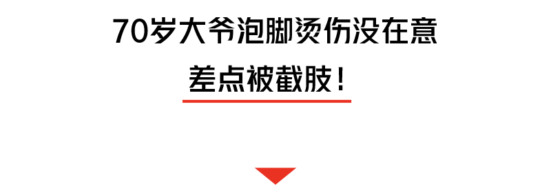 熱水泡腳差點截肢！醫生呼籲：這9類人千萬要注意！ 健康 第5張