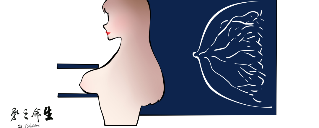 数字钼靶是什么精准+微创：X线数字断层摄影立体定位的乳腺穿刺活检技术_https://www.jmylbn.com_新闻资讯_第2张