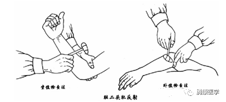 收藏神經系統查體