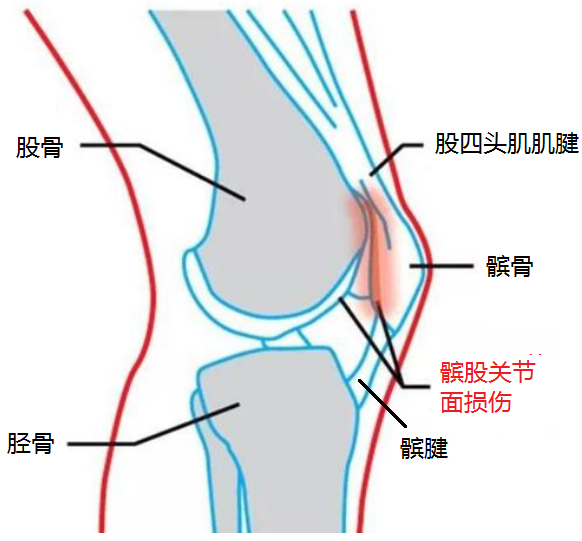 膝关节的位置图示图片
