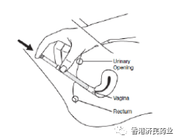 凝胶避孕怎么使用Xaciato（2%克林霉素磷酸酯阴道凝胶）中文说明书_https://www.jmylbn.com_新闻资讯_第9张