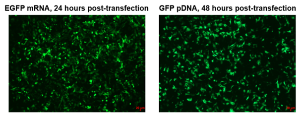 ProteanFect貼壁細胞轉染攻略|LX2轉染操作protocol