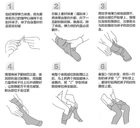 医用弹力袜用什么洗【科普】医用弹力袜，您穿对了吗？_https://www.jmylbn.com_新闻资讯_第7张