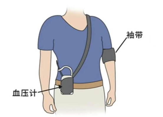 动态血压怎么佩带【科普】动态血压监测  血压的贴身管家_https://www.jmylbn.com_新闻资讯_第2张