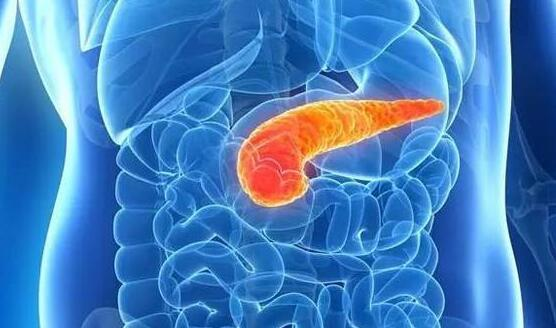 【科普】胰腺癌为何被称为“癌症之王”？