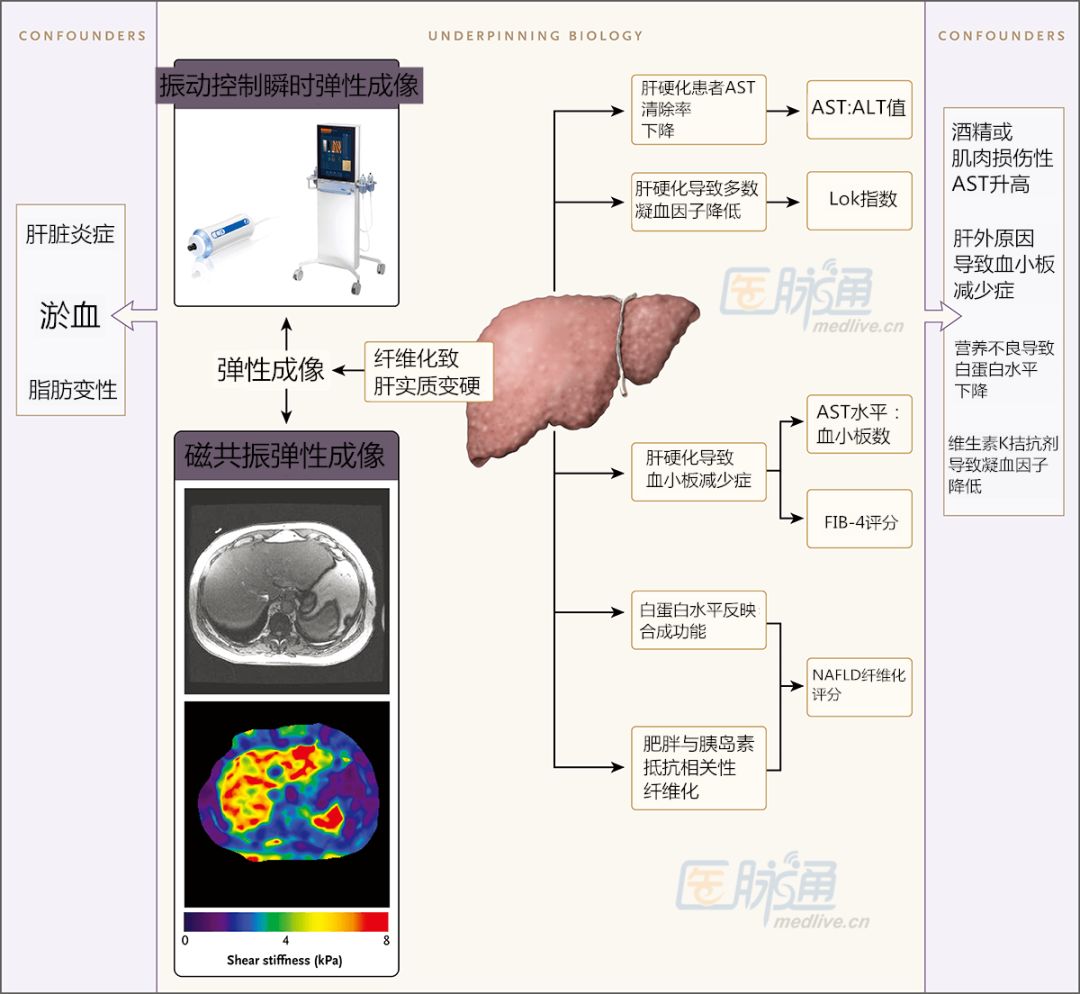 NEJM：選擇肝活檢還是無創檢查？ 健康 第2張