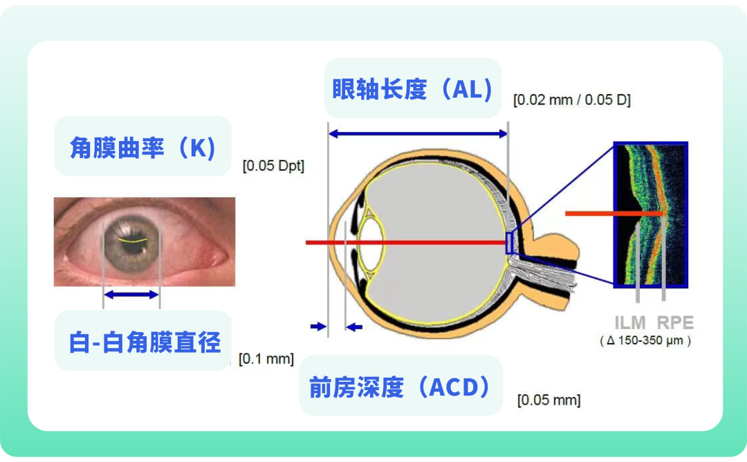 怎么测角膜直径三分钟带您看懂孩子的眼科检查报告单_https://www.jmylbn.com_新闻资讯_第5张