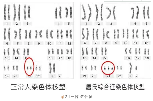 9号染色体倒位必须做试管吗_染色体试管_试管染色体检查结果解读