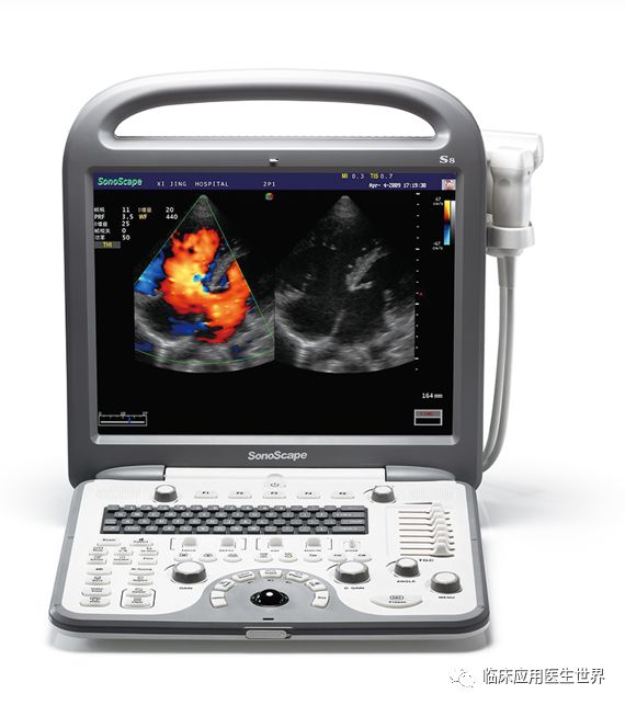 开立超声怎么导出图像273期：超声临床应用医生的银色记忆——盘点超声兵器谱_https://www.jmylbn.com_新闻资讯_第4张