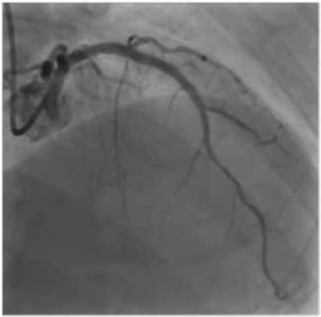 asahi有哪些导丝技术研发与设计思维的完美结合_https://www.jmylbn.com_新闻资讯_第6张