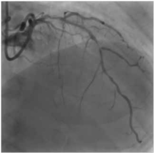 asahi有哪些导丝技术研发与设计思维的完美结合_https://www.jmylbn.com_新闻资讯_第3张