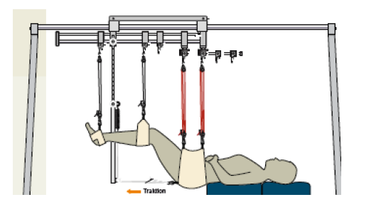 悬吊训练系统 怎么装德国POWER-SLING多点多轴悬吊系统_https://www.jmylbn.com_新闻资讯_第18张